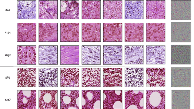 Figure 3 for Improving Interpretability for Computer-aided Diagnosis tools on Whole Slide Imaging with Multiple Instance Learning and Gradient-based Explanations