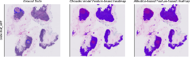 Figure 4 for Improving Interpretability for Computer-aided Diagnosis tools on Whole Slide Imaging with Multiple Instance Learning and Gradient-based Explanations