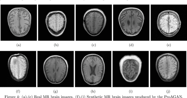 Figure 4 for Progressively-Growing AmbientGANs For Learning Stochastic Object Models From Imaging Measurements