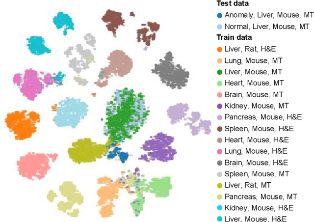 Figure 3 for Learning image representations for anomaly detection: application to discovery of histological alterations in drug development