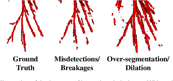 Figure 1 for Alleviating Class-wise Gradient Imbalance for Pulmonary Airway Segmentation