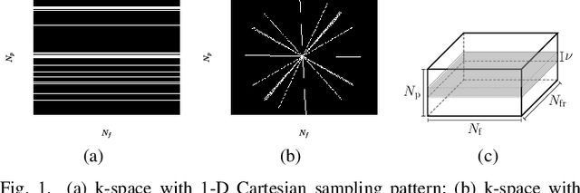 Figure 1 for Bi-Linear Modeling of Data Manifolds for Dynamic-MRI Recovery