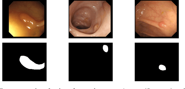 Figure 1 for Automatic Polyp Segmentation Using Convolutional Neural Networks