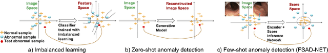Figure 1 for Few-Shot Anomaly Detection for Polyp Frames from Colonoscopy