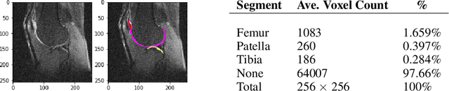 Figure 1 for Knee Cartilage Segmentation Using Diffusion-Weighted MRI