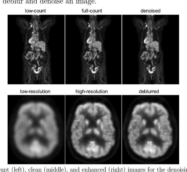 Figure 1 for Artificial Intelligence-Based Image Enhancement in PET Imaging: Noise Reduction and Resolution Enhancement