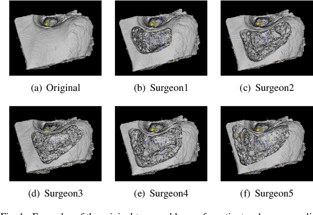 Figure 1 for Learning Non-Unique Segmentation with Reward-Penalty Dice Loss