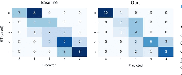 Figure 4 for Leveraging Regular Fundus Images for Training UWF Fundus Diagnosis Models via Adversarial Learning and Pseudo-Labeling
