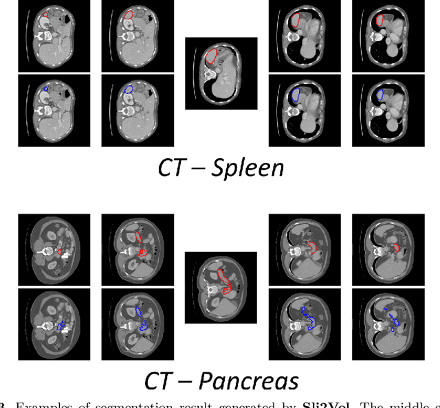 Figure 3 for Sli2Vol: Annotate a 3D Volume from a Single Slice with Self-Supervised Learning
