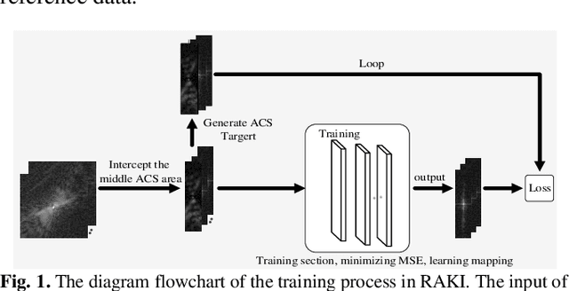 Figure 1 for Multi-Weight Respecification of Scan-specific Learning for Parallel Imaging