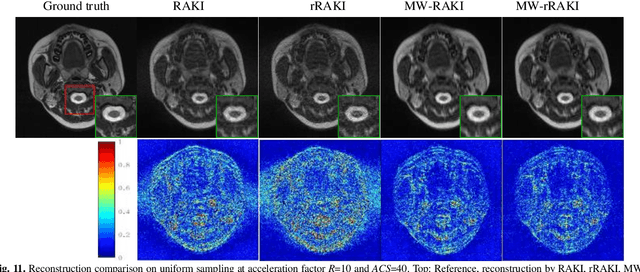 Figure 3 for Multi-Weight Respecification of Scan-specific Learning for Parallel Imaging