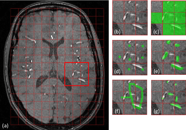 Figure 3 for Vessel-CAPTCHA: an efficient learning framework for vessel annotation and segmentation