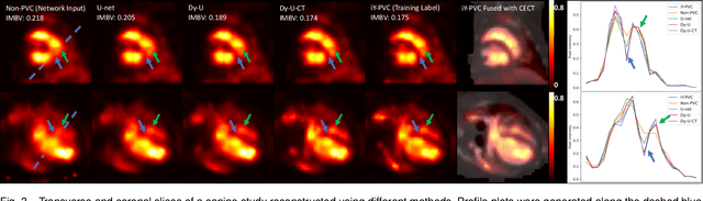 Figure 3 for Segmentation-free PVC for Cardiac SPECT using a Densely-connected Multi-dimensional Dynamic Network
