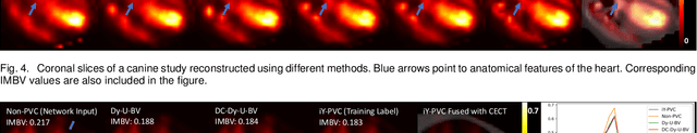Figure 4 for Segmentation-free PVC for Cardiac SPECT using a Densely-connected Multi-dimensional Dynamic Network
