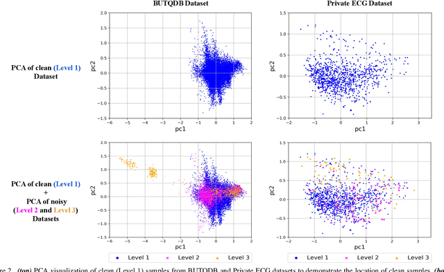 Figure 2 for Automatic Detection of Noisy Electrocardiogram Signals without Explicit Noise Labels