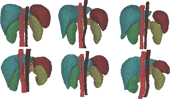 Figure 1 for Prior-aware Neural Network for Partially-Supervised Multi-Organ Segmentation