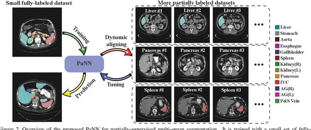 Figure 3 for Prior-aware Neural Network for Partially-Supervised Multi-Organ Segmentation