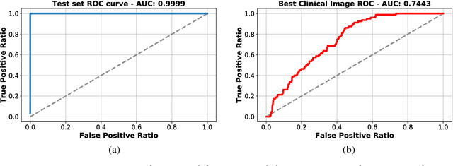 Figure 1 for Data Augmentation for Detection of Architectural Distortion in Digital Mammography using Deep Learning Approach