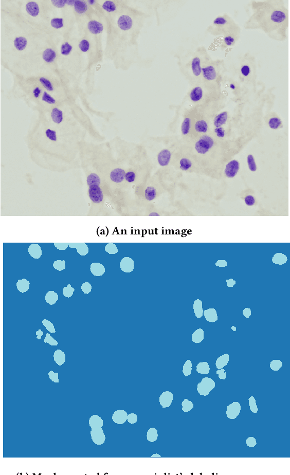 Figure 2 for Towards a Complete Pipeline for Segmenting Nuclei in Feulgen-Stained Images