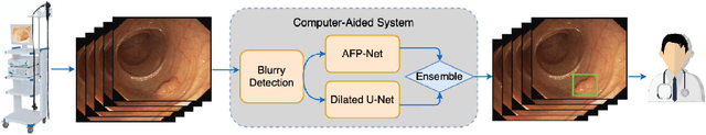 Figure 3 for Colorectal Polyp Detection in Real-world Scenario: Design and Experiment Study