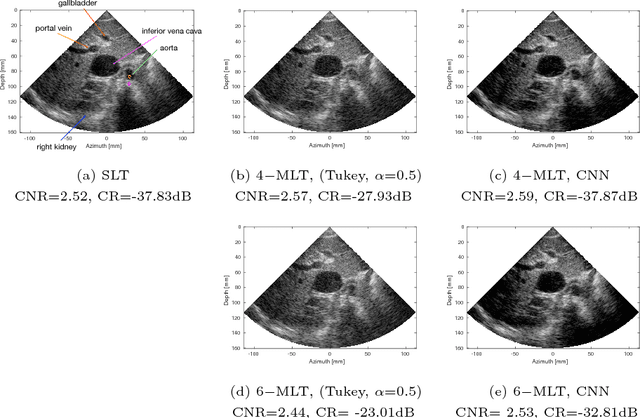 Figure 3 for High quality ultrasonic multi-line transmission through deep learning