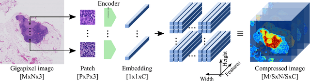 Figure 1 for Neural Image Compression for Gigapixel Histopathology Image Analysis