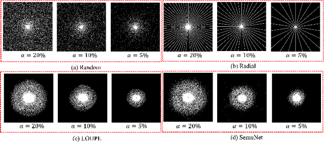 Figure 4 for One Network to Solve Them All: A Sequential Multi-Task Joint Learning Network Framework for MR Imaging Pipeline