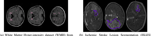 Figure 1 for Effect of Prior-based Losses on Segmentation Performance: A Benchmark