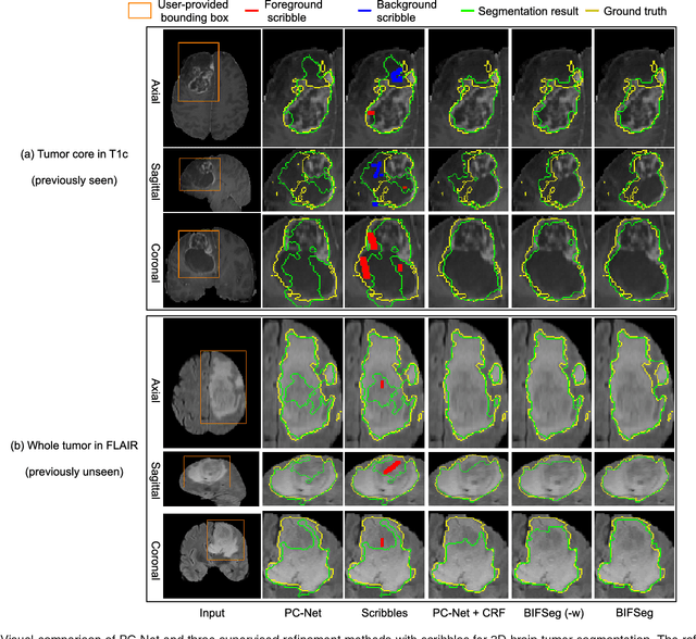 Figure 4 for Interactive Medical Image Segmentation using Deep Learning with Image-specific Fine-tuning