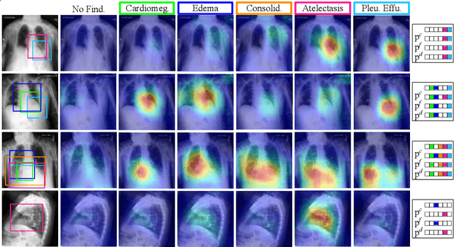 Figure 3 for DECAPS: Detail-Oriented Capsule Networks