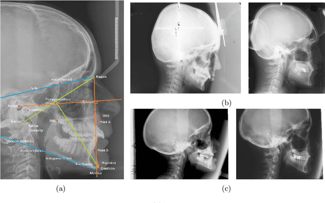 Figure 2 for Prediction of the facial growth direction with Machine Learning methods