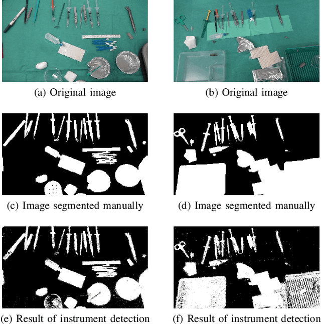 Figure 2 for Coarse-to-fine Surgical Instrument Detection for Cataract Surgery Monitoring