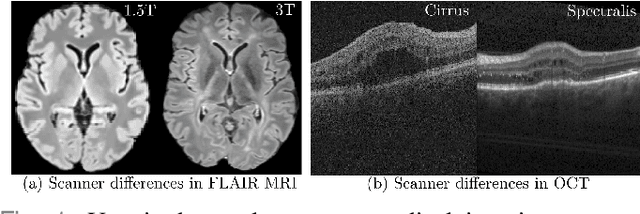 Figure 1 for Segmentation-Renormalized Deep Feature Modulation for Unpaired Image Harmonization