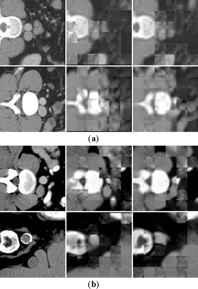 Figure 1 for Self Pre-training with Topology- and Spatiality-aware Masked Autoencoders for 3D Medical Image Segmentation