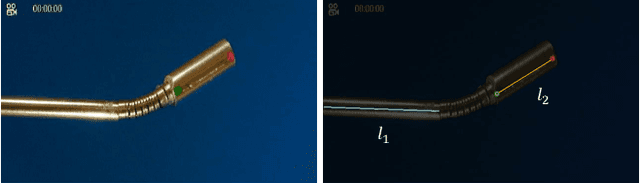 Figure 3 for A Data-Driven Model with Hysteresis Compensation for I2RIS Robot