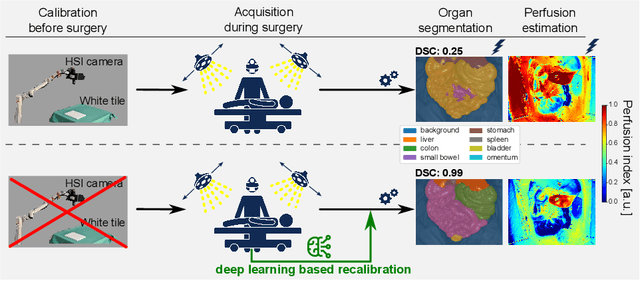 Figure 1 for Deep intra-operative illumination calibration of hyperspectral cameras
