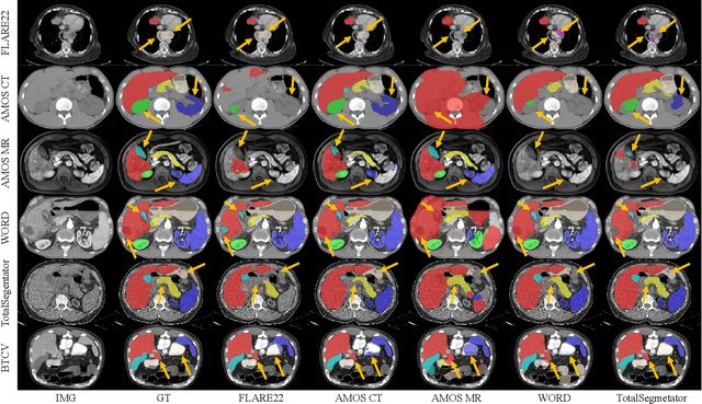 Figure 4 for A-Eval: A Benchmark for Cross-Dataset Evaluation of Abdominal Multi-Organ Segmentation