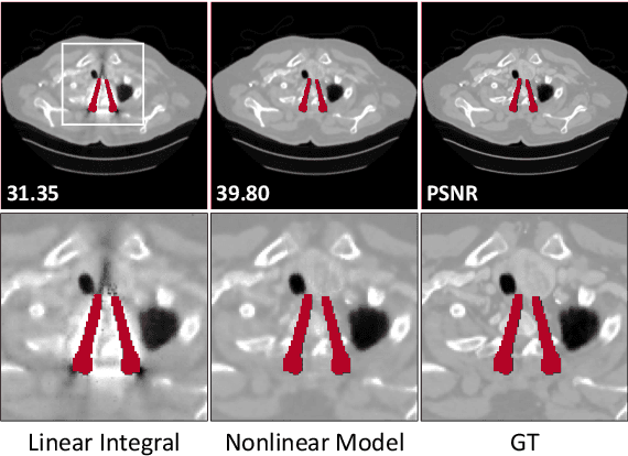 Figure 2 for Unsupervised Density Neural Representation for CT Metal Artifact Reduction