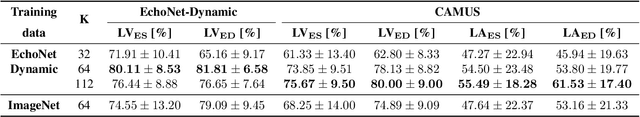 Figure 4 for Unlocking the Heart Using Adaptive Locked Agnostic Networks