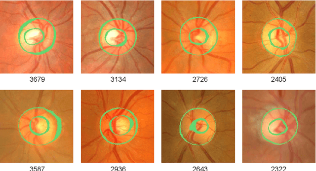Figure 3 for Accurate Segmentation of Optic Disc And Cup from Multiple Pseudo-labels by Noise-Aware Learning