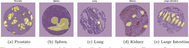 Figure 1 for Switched auxiliary loss for robust training of transformer models for histopathological image segmentation