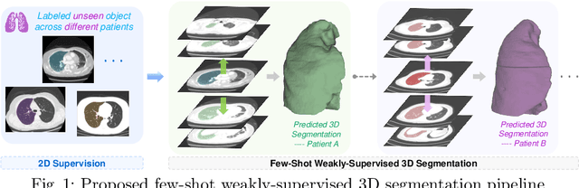 Figure 1 for Few-Shot 3D Volumetric Segmentation with Multi-Surrogate Fusion