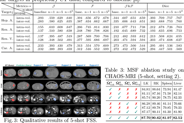 Figure 4 for Few-Shot 3D Volumetric Segmentation with Multi-Surrogate Fusion