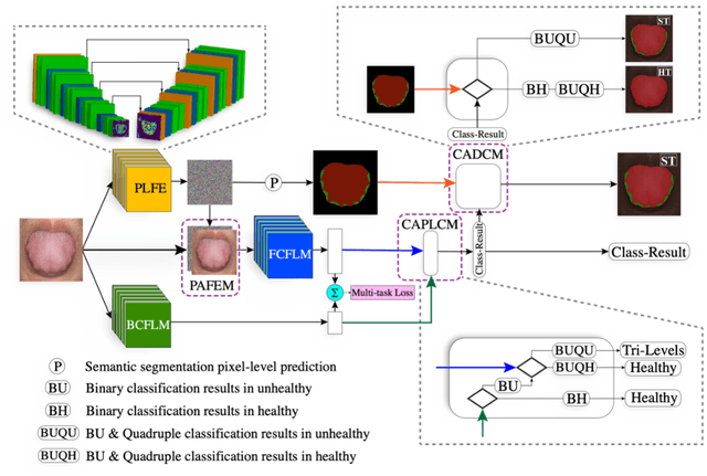 Figure 3 for Ammonia-Net: A Multi-task Joint Learning Model for Multi-class Segmentation and Classification in Tooth-marked Tongue Diagnosis