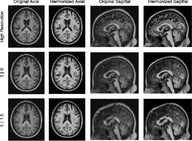 Figure 3 for Beyond MR Image Harmonization: Resolution Matters Too