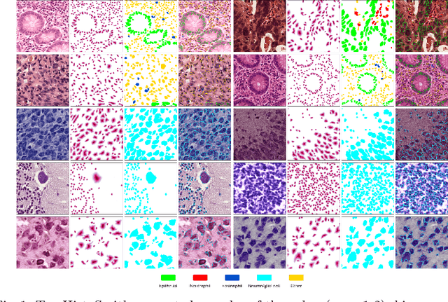 Figure 1 for HistoSmith: Single-Stage Histology Image-Label Generation via Conditional Latent Diffusion for Enhanced Cell Segmentation and Classification