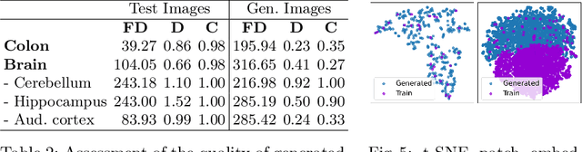 Figure 4 for HistoSmith: Single-Stage Histology Image-Label Generation via Conditional Latent Diffusion for Enhanced Cell Segmentation and Classification