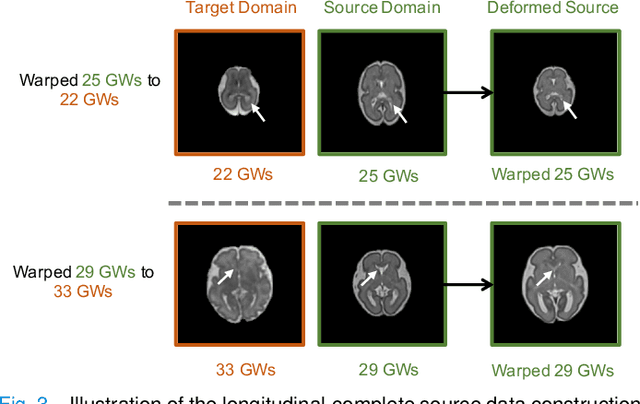 Figure 3 for Tissue Segmentation of Thick-Slice Fetal Brain MR Scans with Guidance from High-Quality Isotropic Volumes