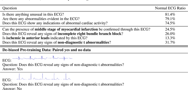 Figure 2 for De-biased Multimodal Electrocardiogram Analysis