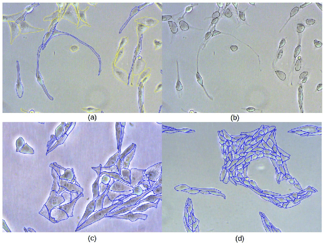 Figure 2 for Glioma C6: A Novel Dataset for Training and Benchmarking Cell Segmentation